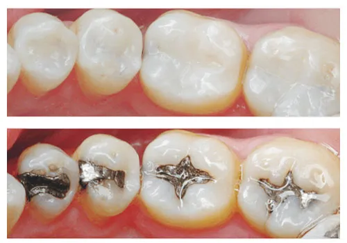 Close-up of a dentist using digital X-ray technology