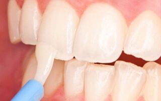 Smiling child during a pediatric dental checkup at Toland Dental