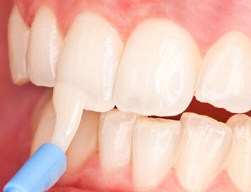 Top 7 Signs You Should See a Dentist in West Melbourne, FL