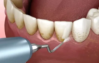 Pediatric dentist using a gentle approach for a child’s dental exam