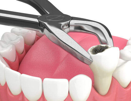 Finding a Family Dentist You Can Trust in West Melbourne, FL: What Locals Should Know