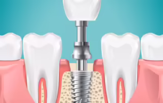 Close-up of a patient receiving a dental X-ray