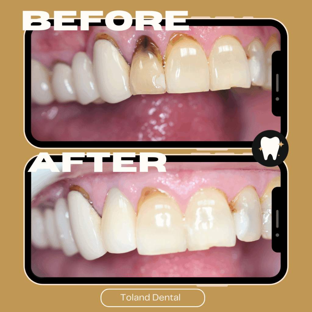 Home before after dental 3