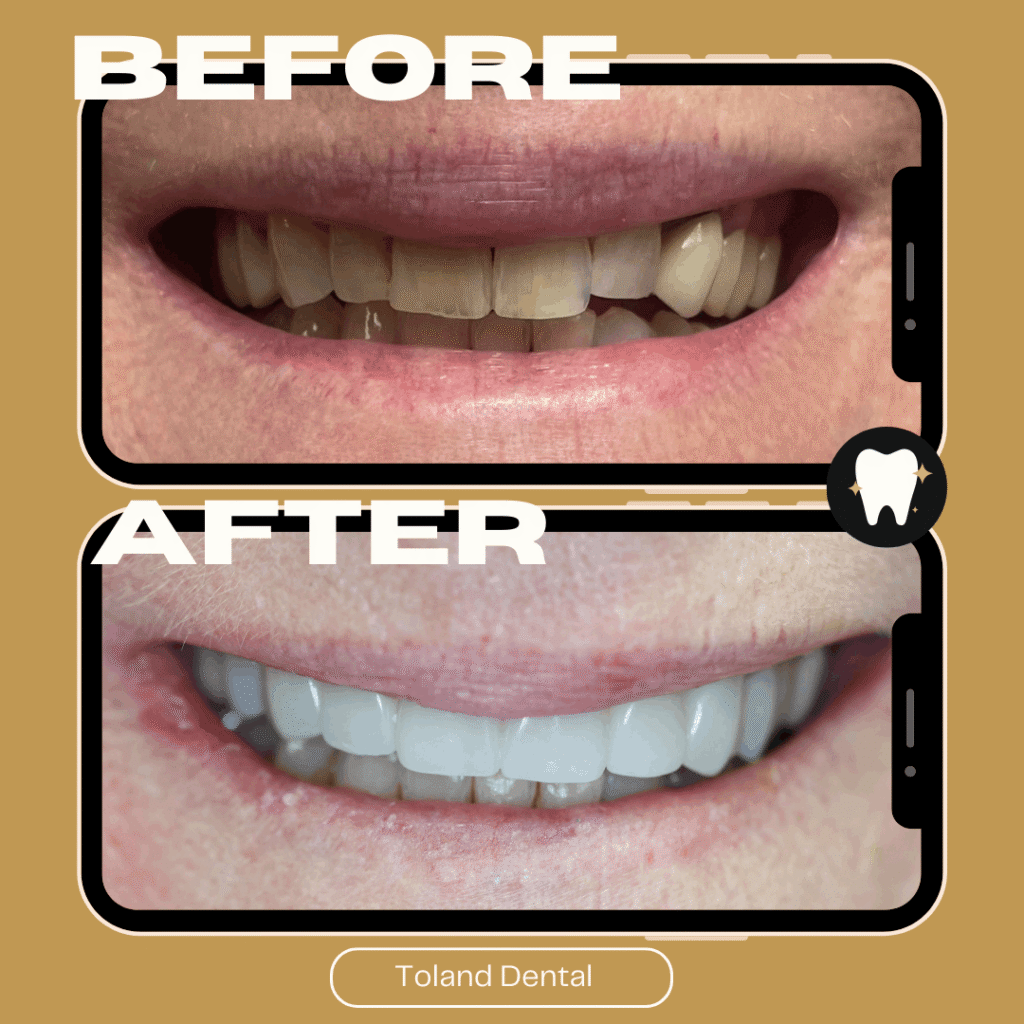 Home before after dental 4