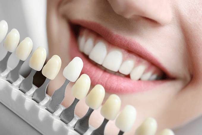 Home Cosmetic dentistry in Melbourne FL